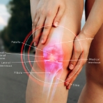 knee-pain-relief